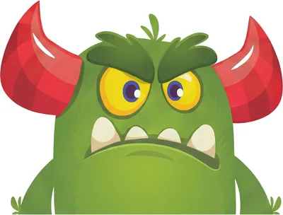 Illustration of Class III Underbite