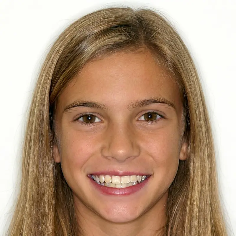 After treatment: The Expansion Phase