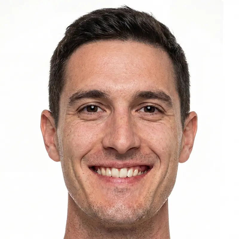 Before treatment: Complex Bite Correction