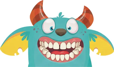 Illustration of Open Bite