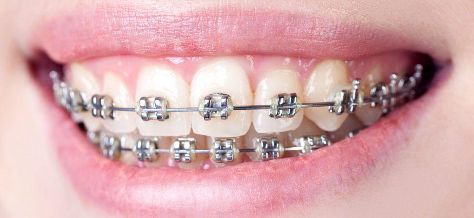 A Complete Guide to Family Orthodontics